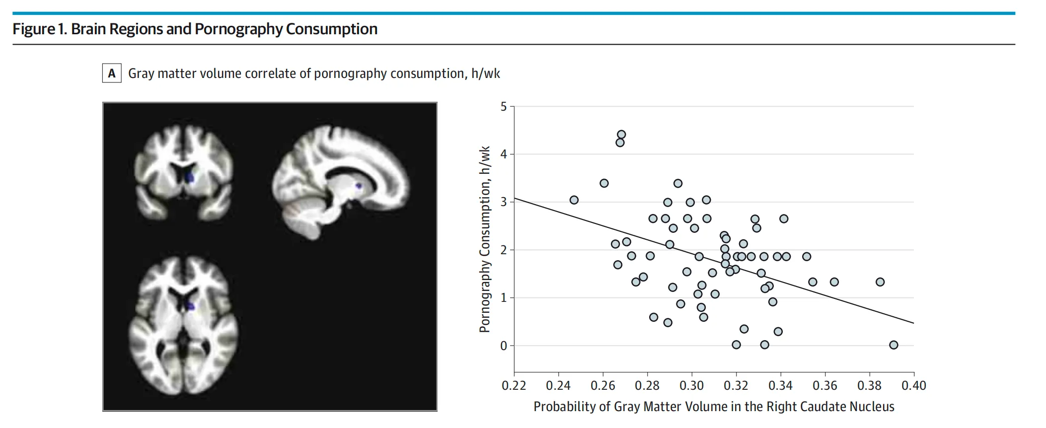 The relationship between time spent viewing pornography and brain gray matter volume